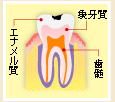 虫歯の状態（軽度）